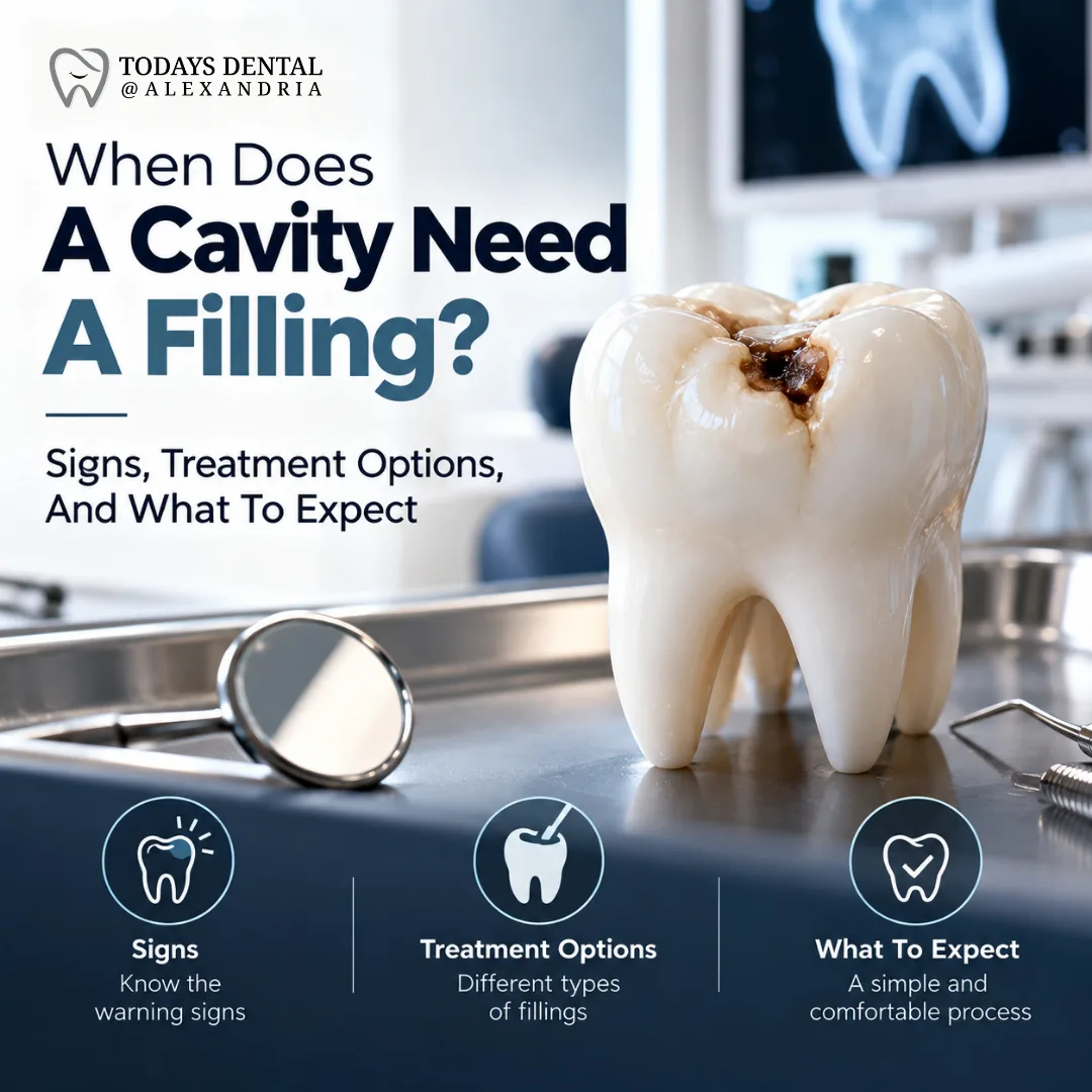 When Does A Cavity Need A Filling? Signs, Treatment Options, And What To Expect