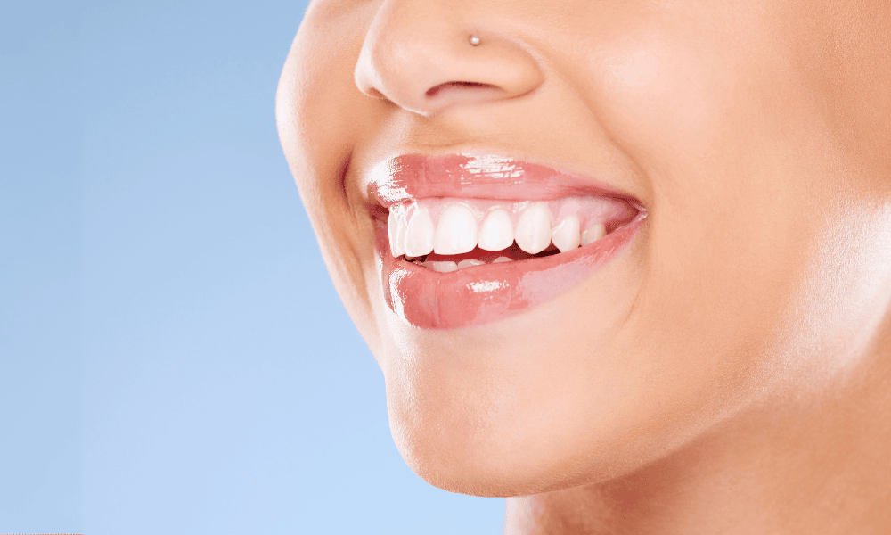 Teeth Whitening Procedure